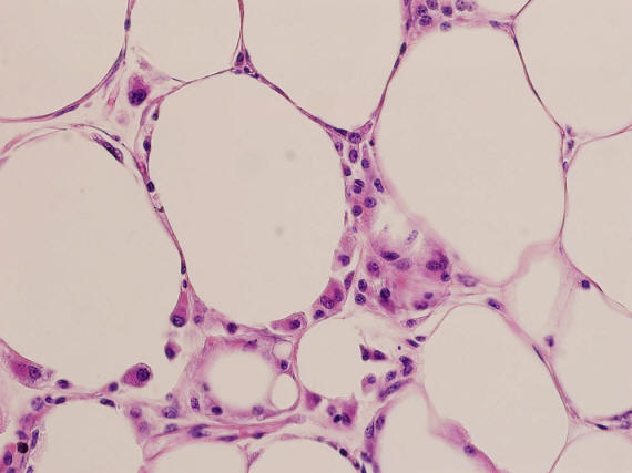 0218 10 tény a testtömegről