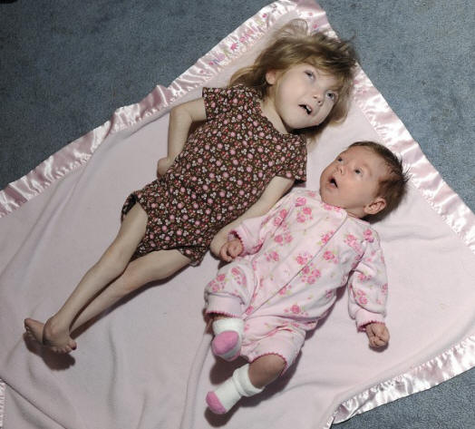 Egy 8 éves kislány testével rendelkezik az örök ifjúság titka