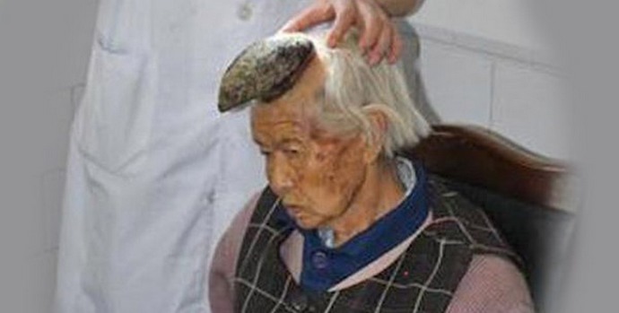 És a nő szélén lévő szarv nő