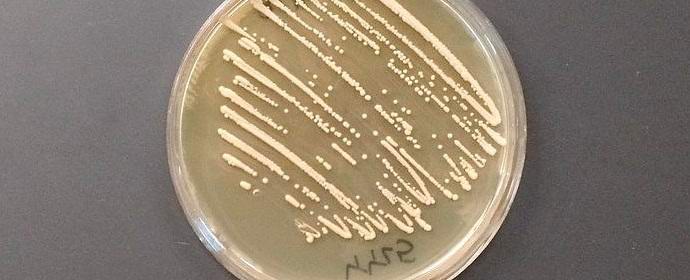 Az amerikaiak az élesztőt tenyésztették, amely cukorréssé vált ópiumba