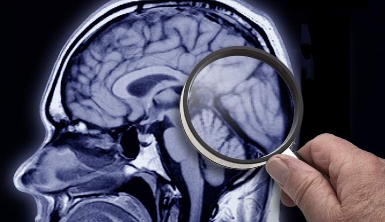 Az amerikaiak hamarosan elkezdenek feltölteni a halottakat.