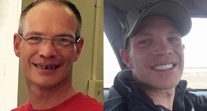 Az amerikai huszonötezer pincért hagyott fogászati ​​kezelésre