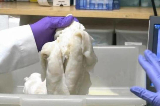 Az amerikai tudósok emberi tüdőt termesztettek