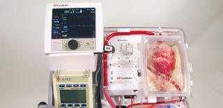 Az ausztrál orvosok megtanultak átültetni halott szívvel rendelkező embereket