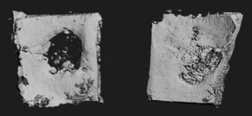 Lehetséges-felhasználások-for-fogászati-tól-implantátumok-to-craniofacialis-hibák