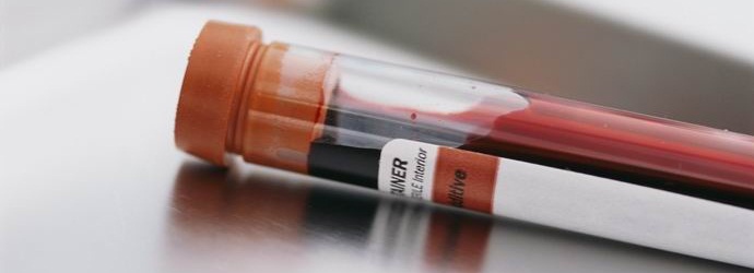 Az embernek harmincöt ismert vérfajtája van.