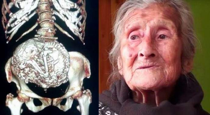 A chilei hat évtizede gyermeke volt.