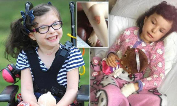 Egy lány, aki nem érzi a fájdalmat