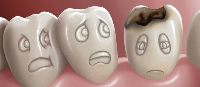 Két és fél milliárd földlakó nem akarja a fogszuvasodást kezelni