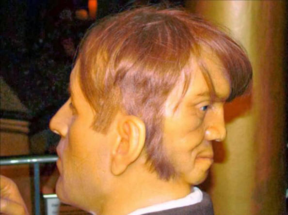 Két arcú ember, Edward Mordrake