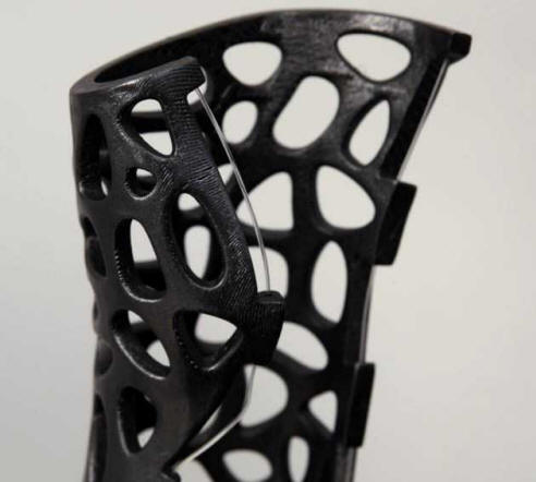 Az ultrahangos gipsz 80% -kal gyorsabban gyógyítja meg a töréseket.