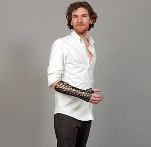 Az ultrahangos gipsz 80% -kal gyorsabban gyógyítja meg a töréseket.