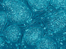 A holland tudósok felajánlják, hogy az egész világot őssejtek húsával táplálják