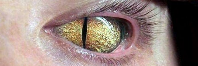 A hüllők kék vére. Hogyan áll társul Obama a hüllőkkel?