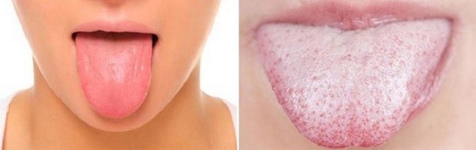 Szeretné tudni az egészségét - vedd fel a tüköret