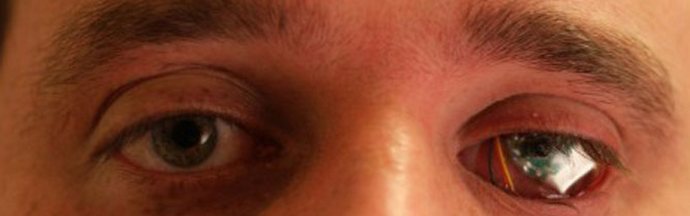 És jöjjön fel egyre tökéletesabb ... mankóval