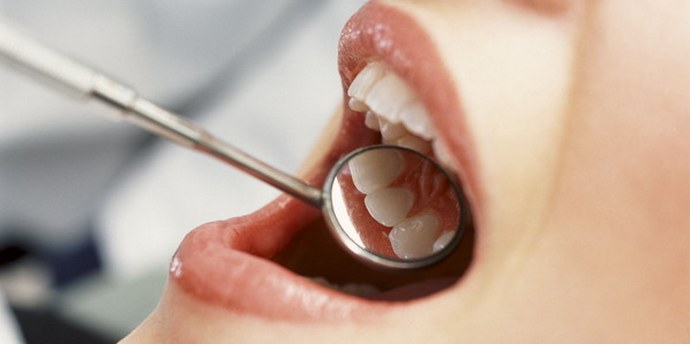 Hogyan lehet az egészséges és erős fogakat fenntartani?