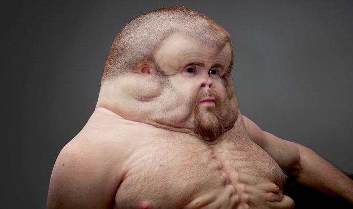 Hogyan néz ki egy súlyos balesetekben túlélni képes ember?