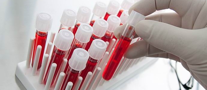 A kanadaiak az összes vérfajtát összeegyeztethetővé teszik.