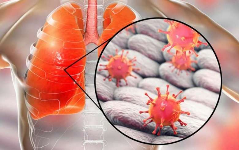 A kínai koronavírus mint a globalisták ruhapróba (verzió)