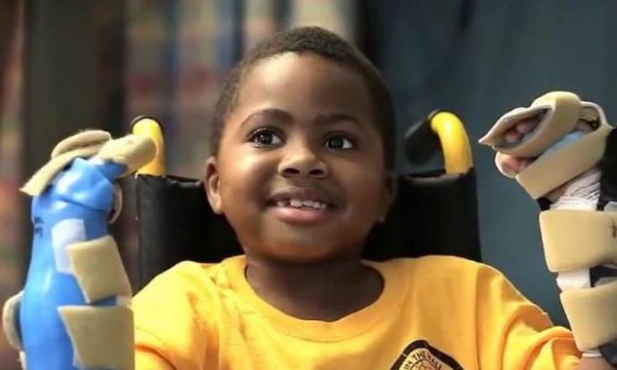 A fiú visszanyerte a kezét