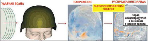 A töltés elsősorban a szemöldök területére koncentrálódik.