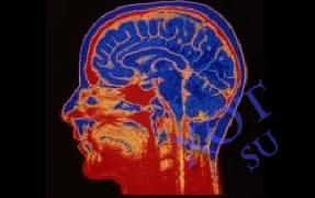 Az agyimplantátumok segítenek az embereknek a hatékonyabb munkában.