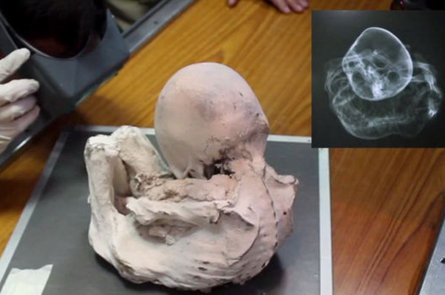 Nazcai múmiák: mit mutatott az ötödik tanulmány