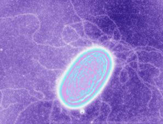 Az egyik elektromos baktérium