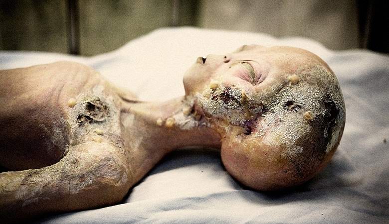 A legendás idegen boncolási videó talált rendezője