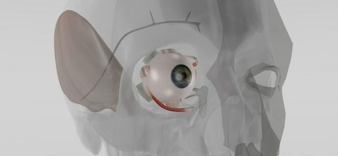 A németek egy implantátumot fedeztek fel az intraokuláris nyomás szabályozására.