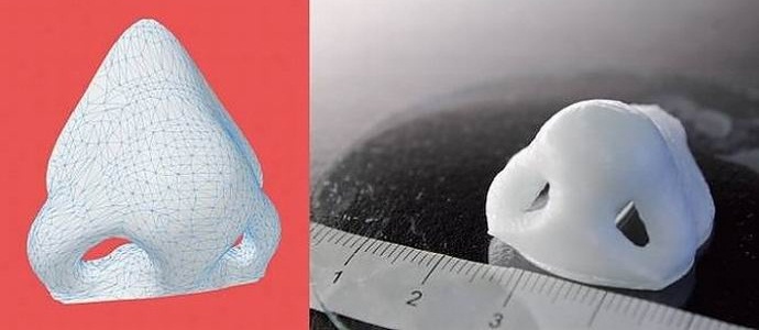 Egy szokatlan nyomtató protéziseket hoz létre az emberi szövetekből