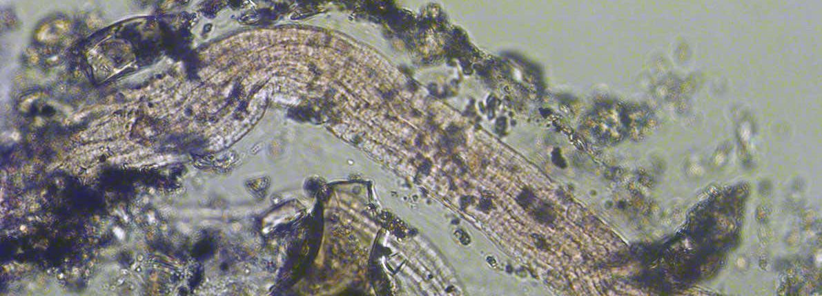 Új típusú anyagcsere található a baktériumokban 