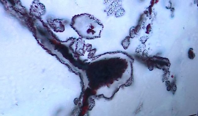 A földi élet legkorábbi bizonyítékát fedezték fel 