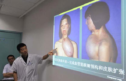 Egy újabb sokkoló plasztikai műtétet végeztek Kínában.