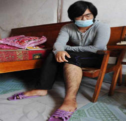 Az orvostudományból egy fiatal kínai nő hajjal nőtte ki magát