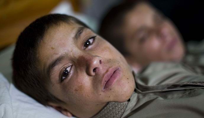 A pakisztáni fiúk rejtélyes módon