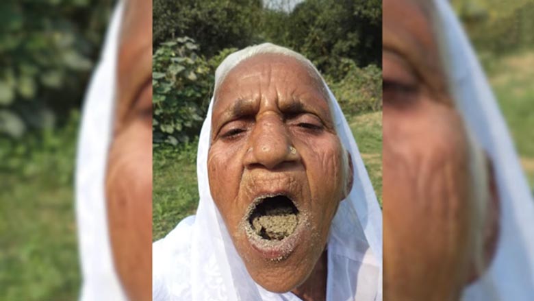 Homokdiet - betegség vagy az egészség garanciája?