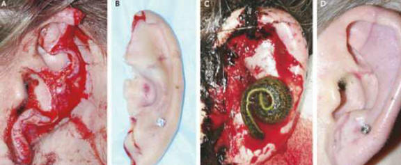 A póréhagyma segített a sebészeknek, hogy helyreállítsák a kutya fülének szakadt fülét