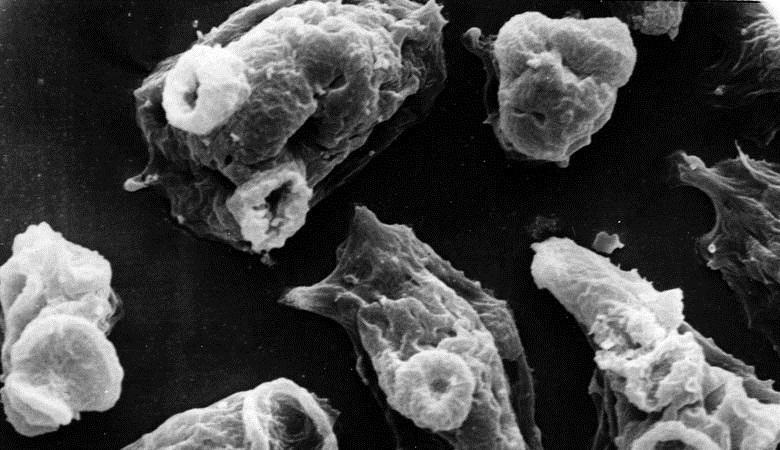 Az agyi améba az IRMA hurrikánt hozta az USA-ba