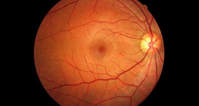 A Marsba történő repülés megfoszthatja az űrhajósokat a látástól