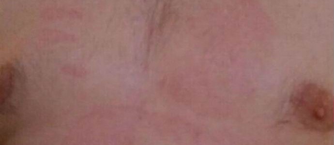 A poltergeista pálma megégette a Novorosszijszki mellkasát