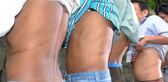 Eladj egy vesét és vesz egy házat