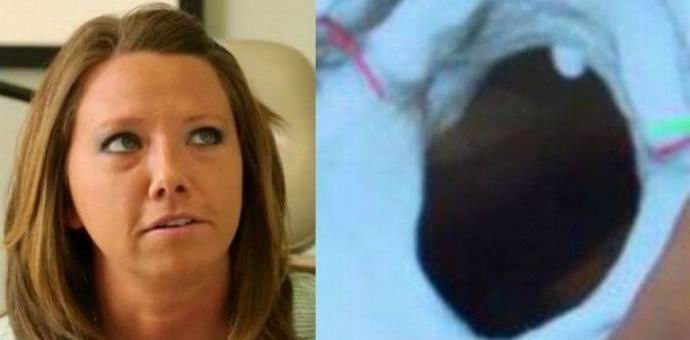 Egy ritka betegség miatt az amerikaiak hallják testének működését.