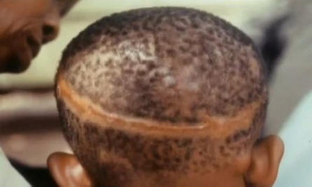 Kapcsolódnak-e születési jelek az erőszakos halálhoz az elmúlt életben?