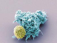 A vírusok segítségével az emberiséget az orr vezeti