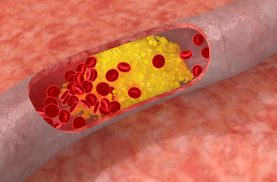 Az emberekben ritka genetikai mutációk eredményeként megszerzett képességek