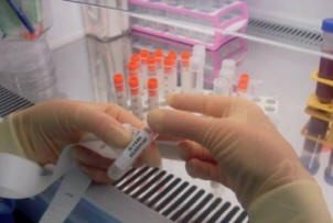 A tudósoknak sikerült a rendes sejteket őssejtekké alakítani