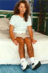 Talált szőrös harisnya nemi erőszakkal szemben