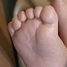 A Fukushima környékén nő a hatujjú csecsemők száma